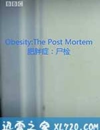 解剖肥胖 Obesity: The Post Mortem (2016)