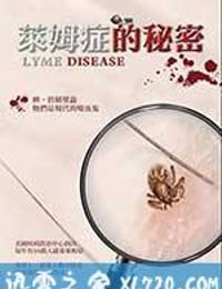 莱姆症的秘密 (2017)