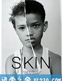 肤色 Skin (2018)