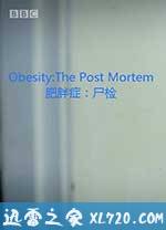 解剖肥胖 Obesity: The Post Mortem (2016)